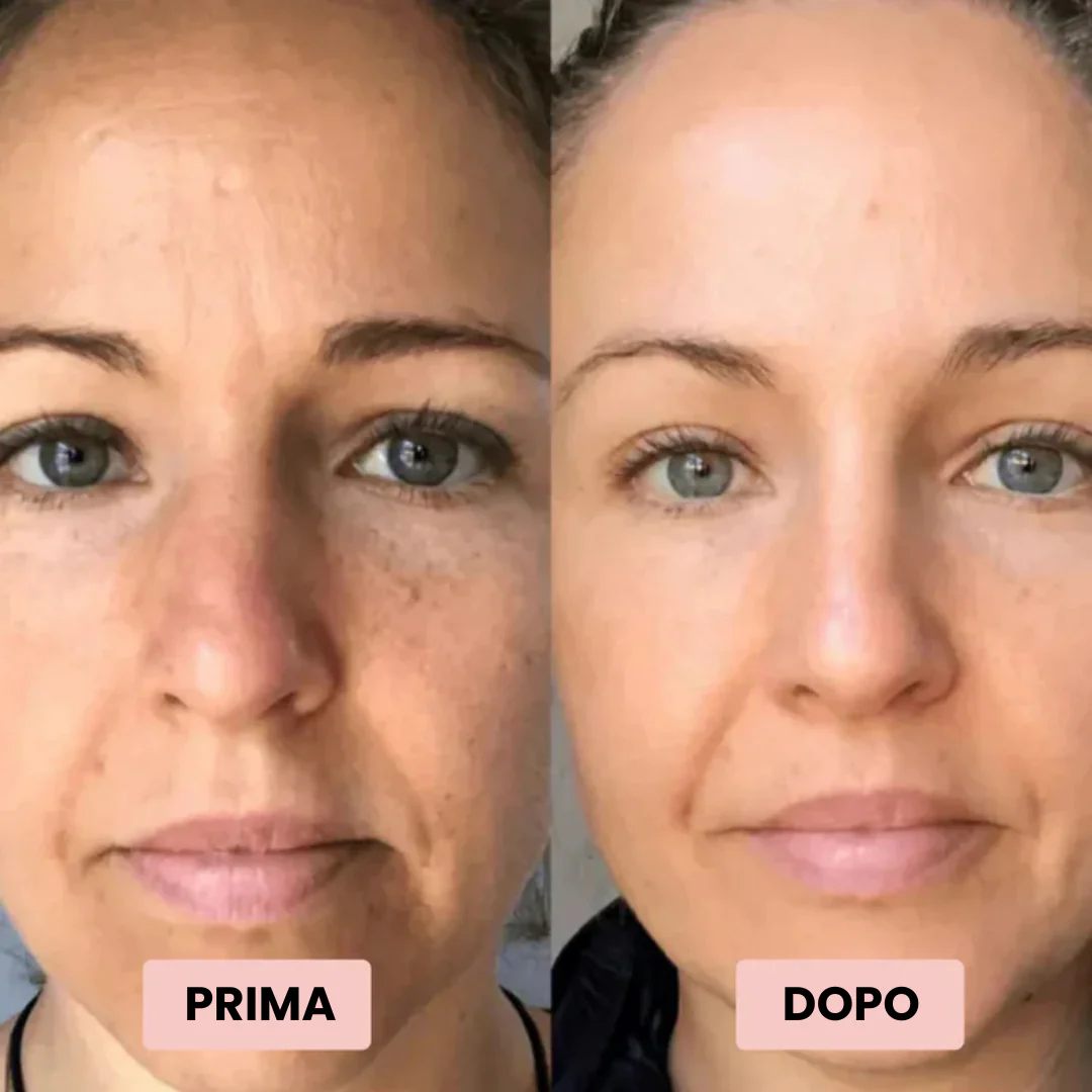 Risultati reali siero DEMETRA cliente 3